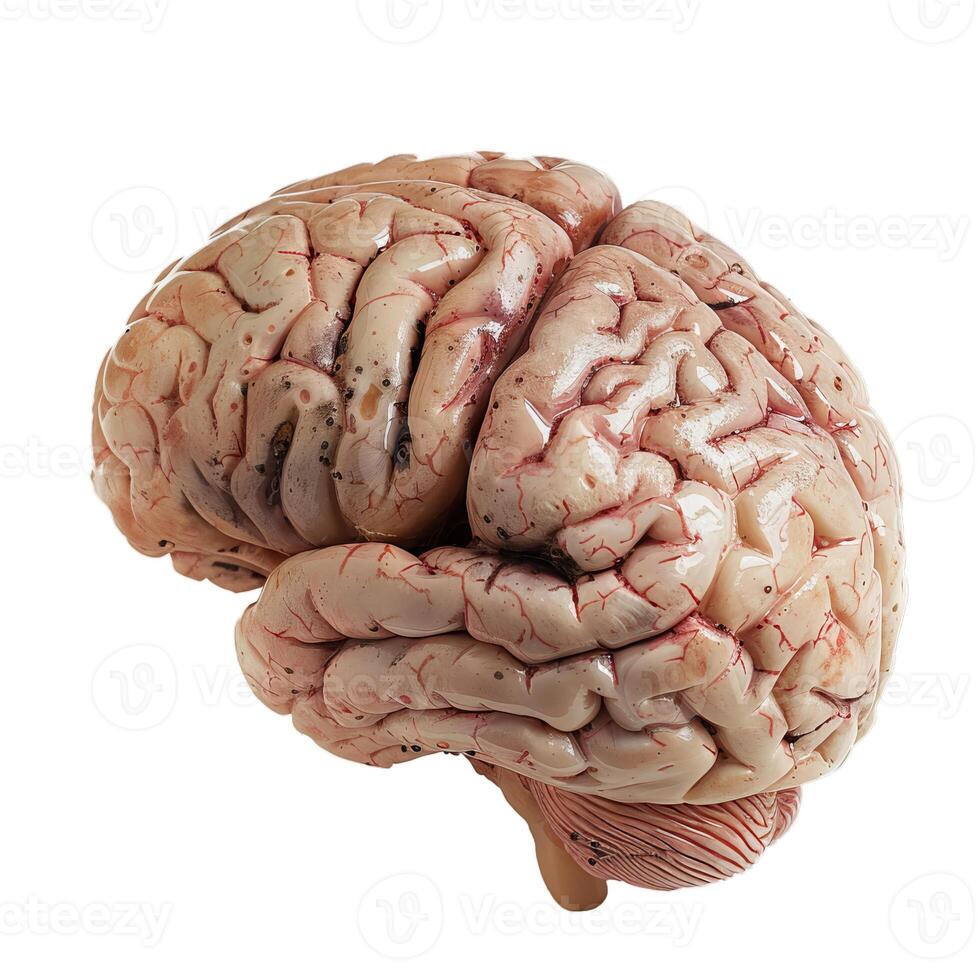 Realistic model of a human brain showing signs of severe disease photo