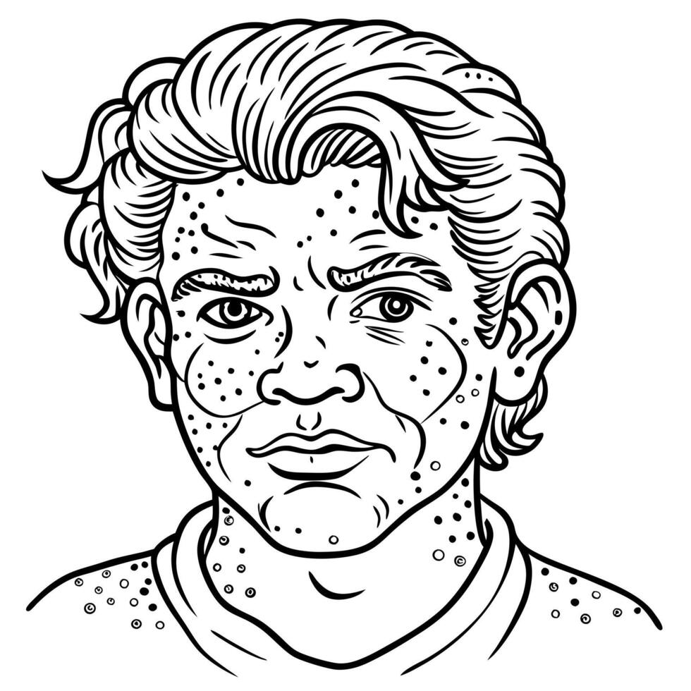 dermatitis, illustration line art vector