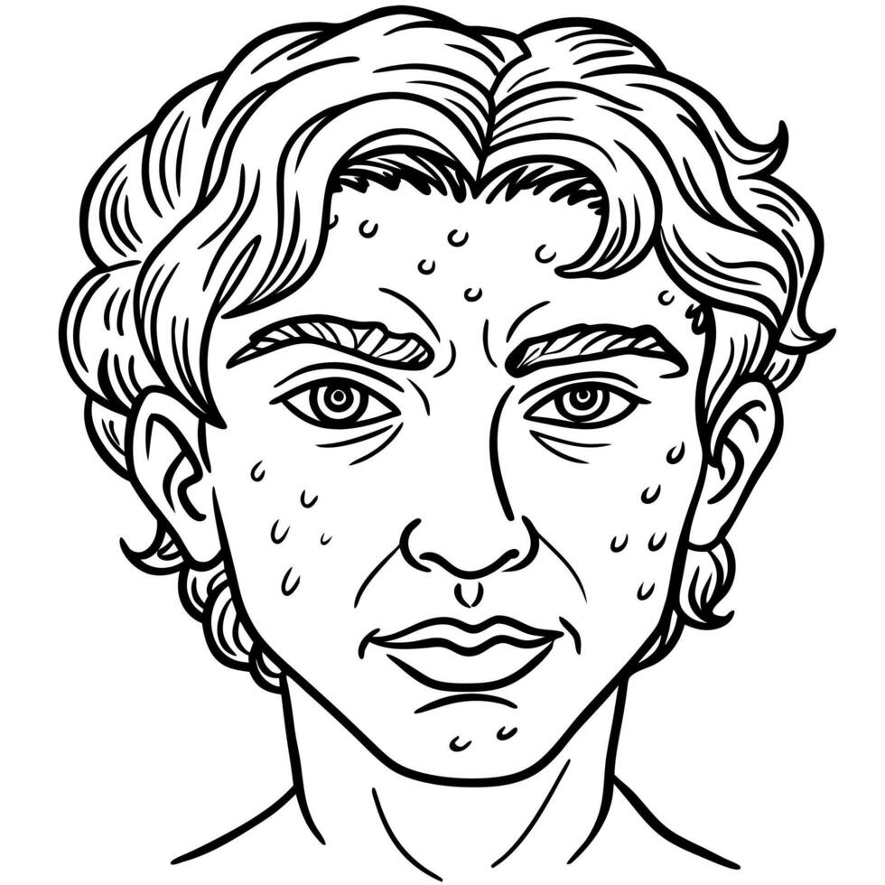 A man with acne on his face vector