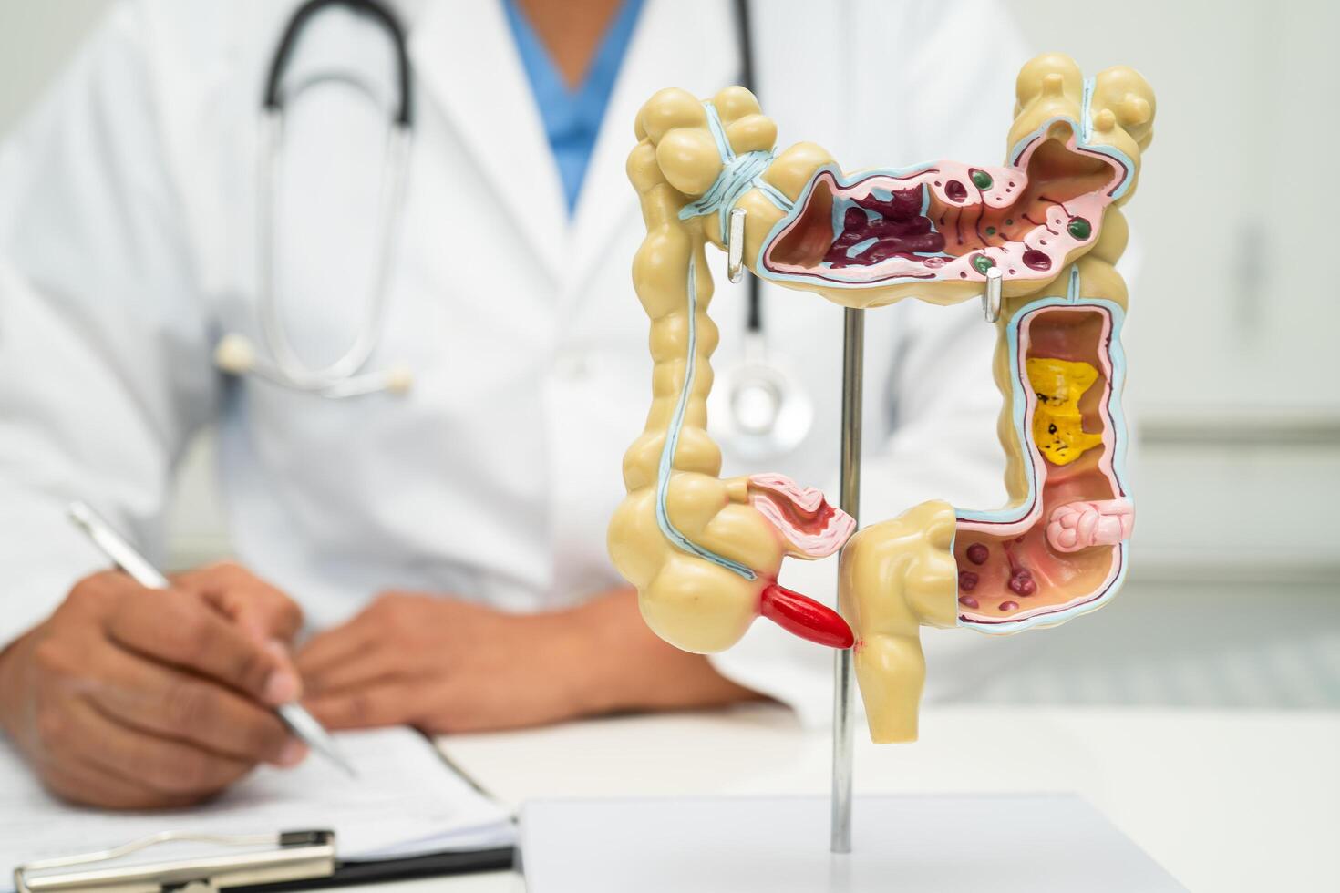 Intestine, appendix and digestive system, doctor holding anatomy model for study diagnosis and treatment in hospital. photo