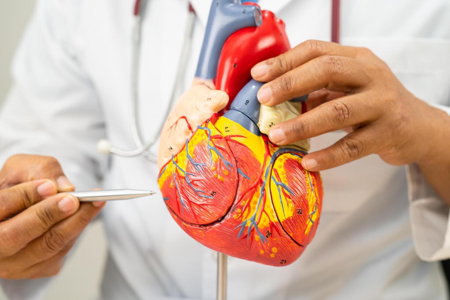 Cardiovascular disease CVD, Asian doctor holding human anatomy model for learn and treat heart disease. photo