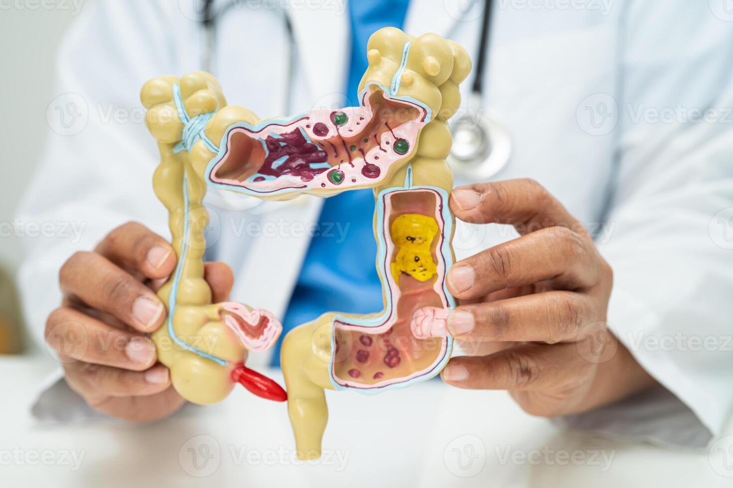 Intestine, appendix and digestive system, doctor holding anatomy model for study diagnosis and treatment in hospital. photo