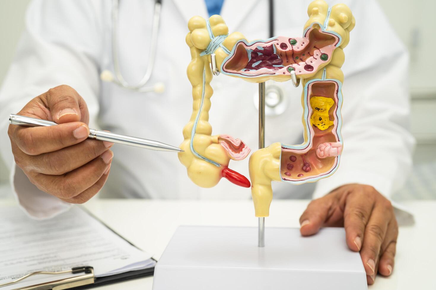Intestine, appendix and digestive system, doctor holding anatomy model for study diagnosis and treatment in hospital. photo