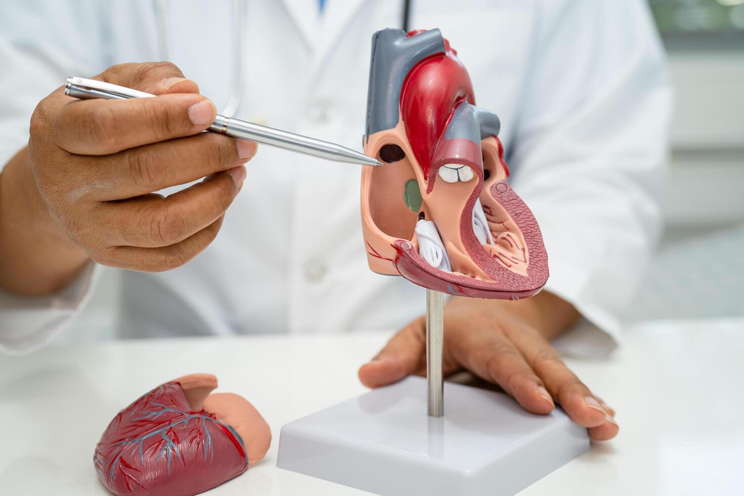 Cardiovascular disease CVD, Asian doctor holding human anatomy model for learn and treat heart disease. photo