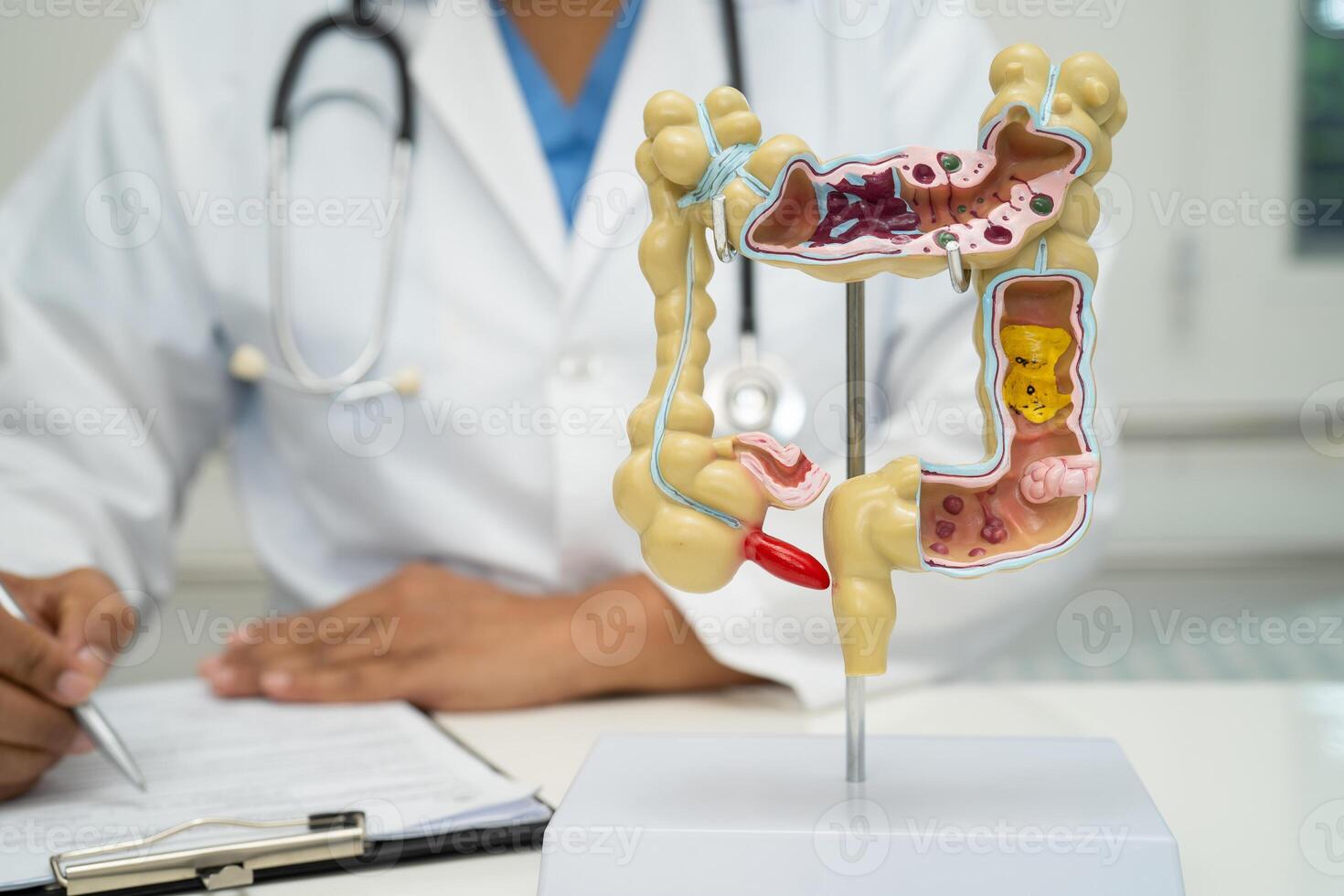 Intestine, appendix and digestive system, doctor holding anatomy model for study diagnosis and treatment in hospital. photo