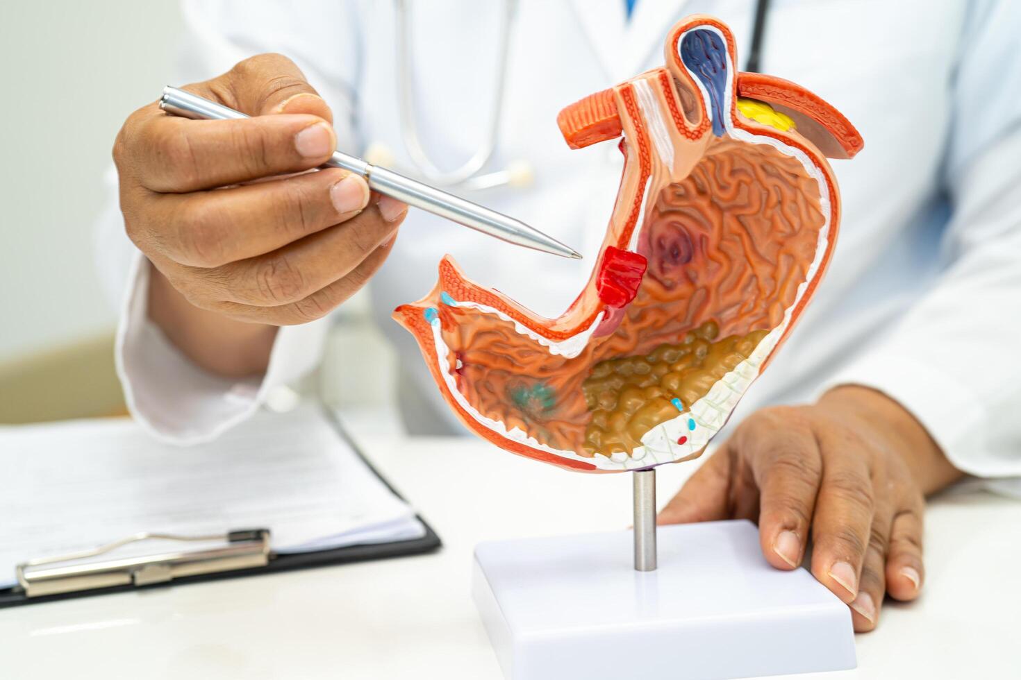 Stomach disease, doctor with human anatomy model for study diagnosis and treatment in hospital. photo