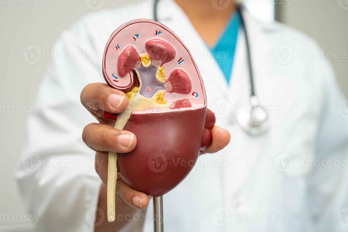 Cardiovascular disease CVD, Asian doctor holding human anatomy model for learn and treat heart disease. photo