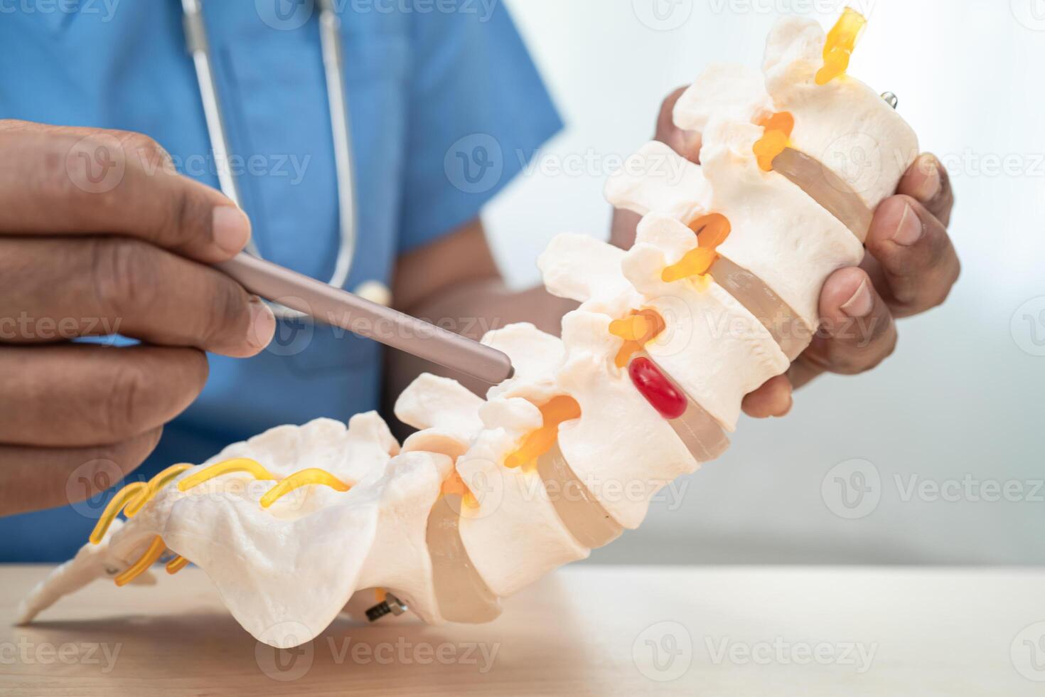 Doctor with lumbar vertebra bone skeleton and nerve model for treatment in the orthopedic department. photo