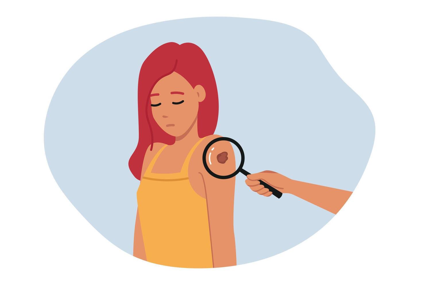 Melanoma or malignant tumor found on shoulder of woman standing near magnifying glass vector