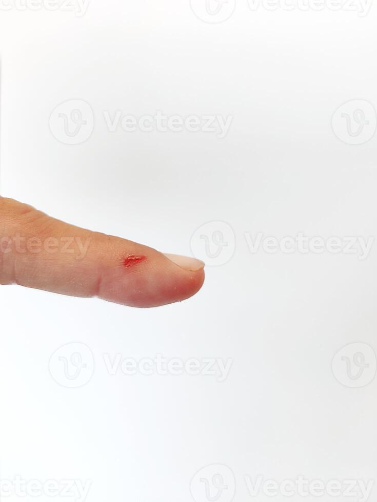 Close-up view of finger with wound and blood on white isolated background photo