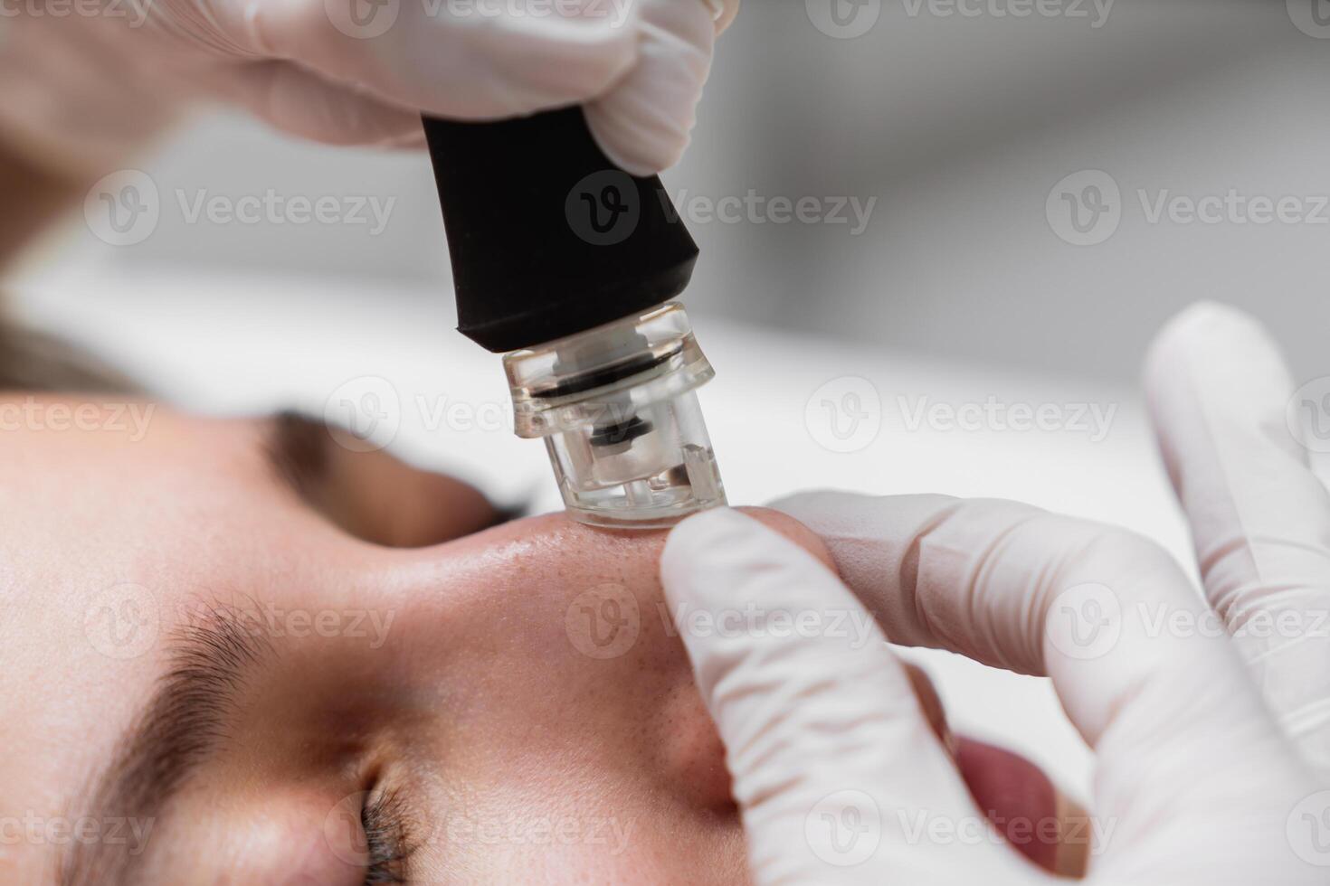 Treatment of women's facial skin in a beauty salon. photo