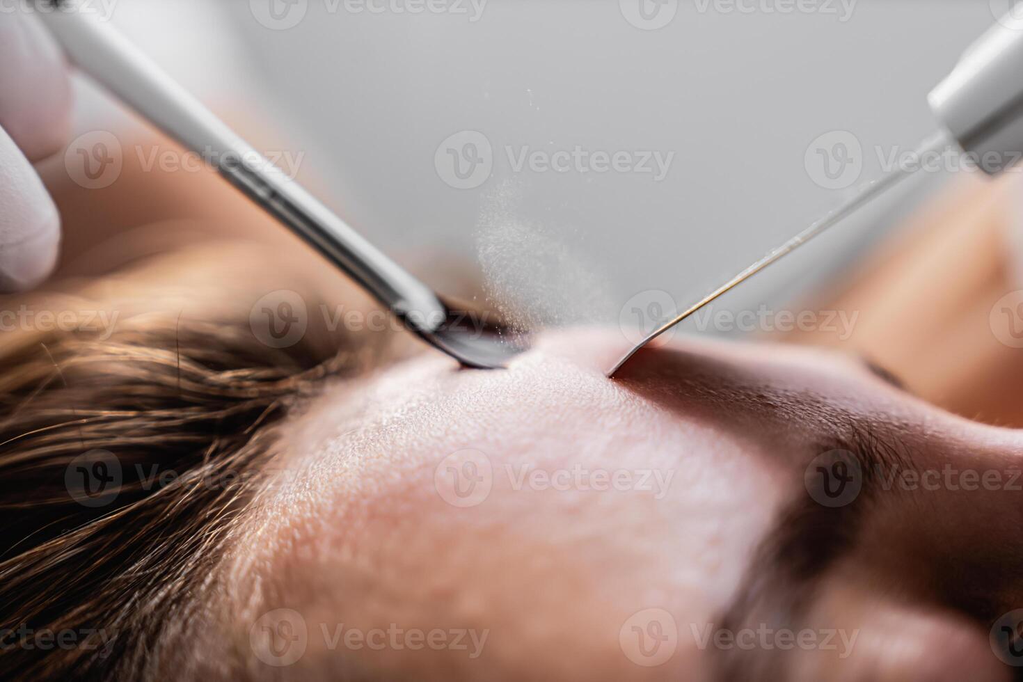 Ultrasonic cleaning of the face. Skin peeling. photo