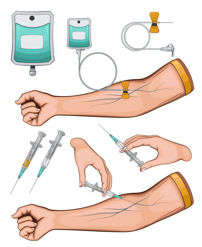 IV drip illustration. Intravenous therapy. Medicine elements background. Medical Education Illustration. vector