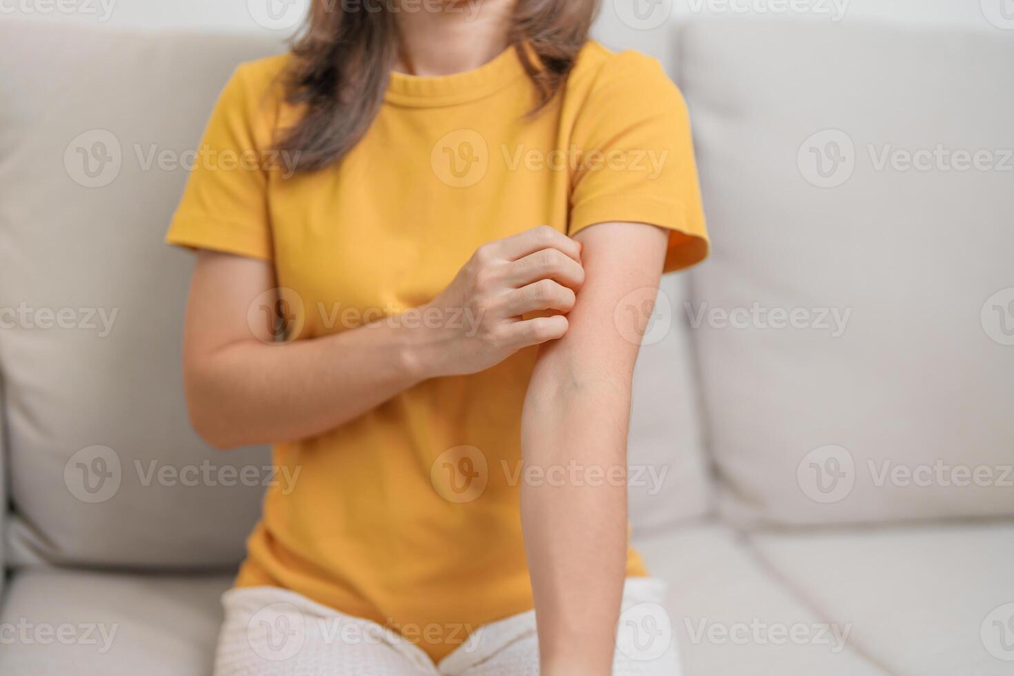 woman itching and scratching itchy arm. Sensitive Skin Allergic reaction to insect bite, food, drug dermatitis. Dermatology, Leprosy day, Systemic lupus erythematosus, Allergy symptoms and rash Eczema photo