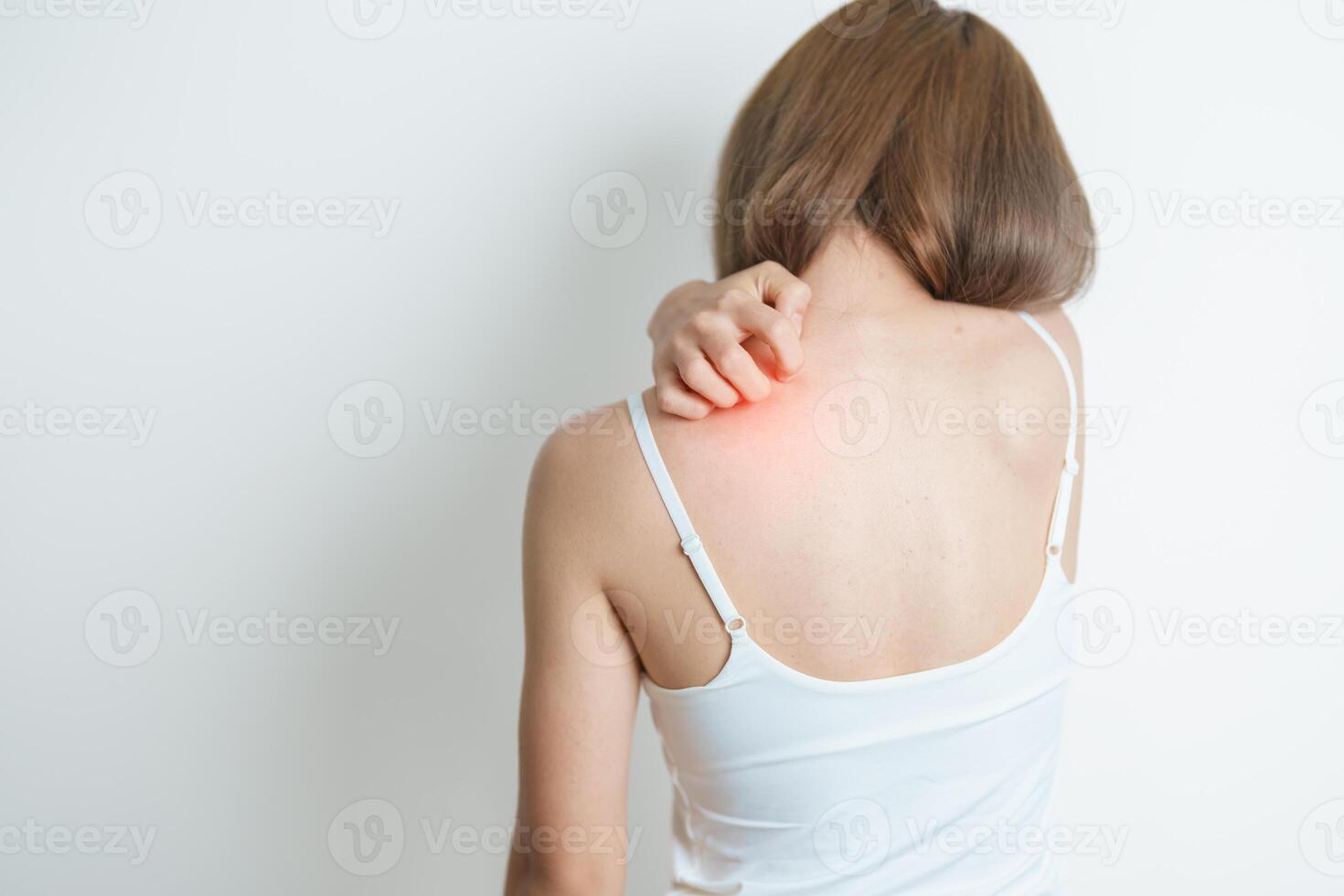 woman itching and scratching itchy back. Sensitive Skin Allergic reaction to insect bite, food, drug dermatitis. Dermatology, Leprosy, Systemic lupus erythematosus, Allergy symptoms and rash Eczema photo