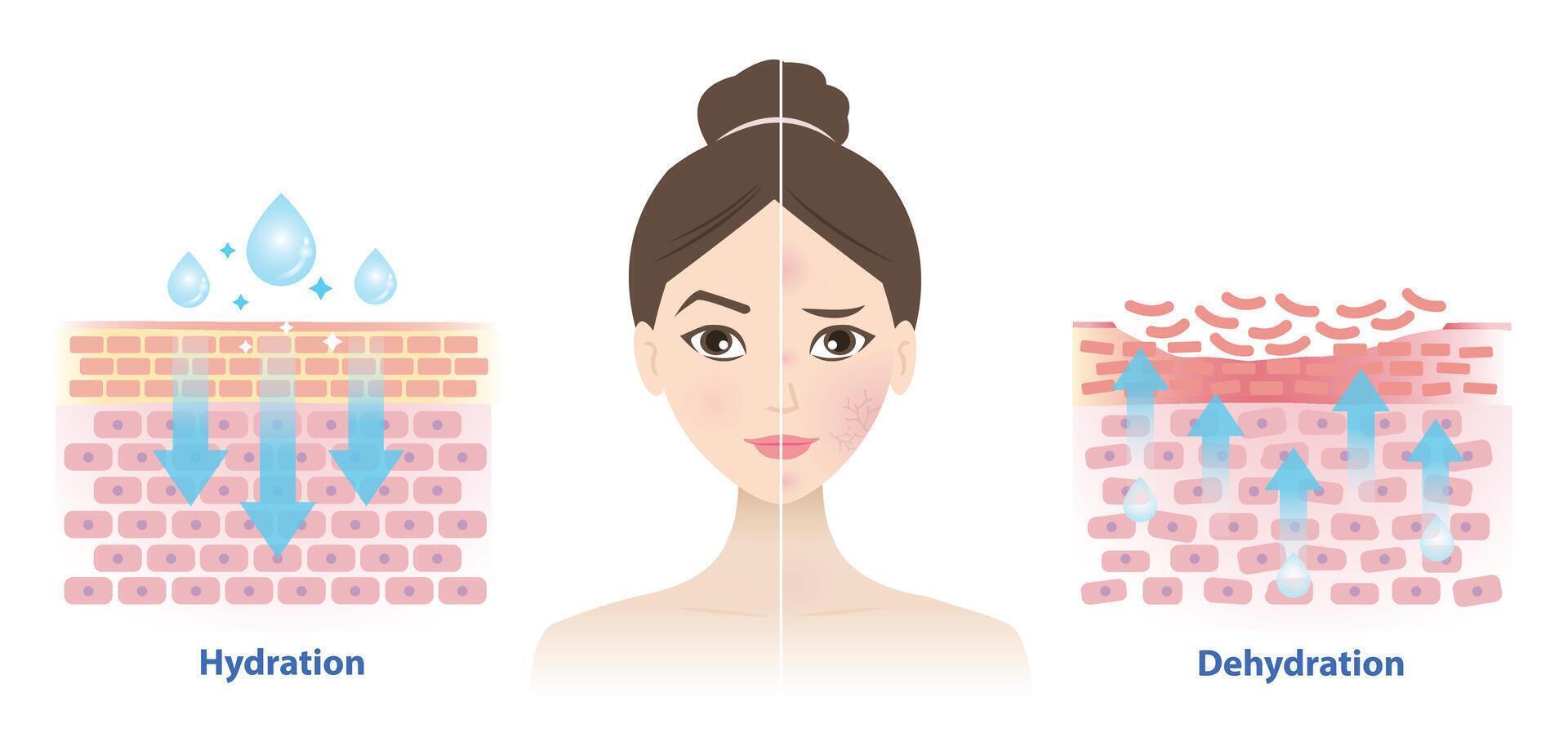 Comparison of hydration and dehydration skin on woman face illustration on white background. The mechanism of skin absorb water, moisture and dry skin lacks water in the uppermost layer. vector