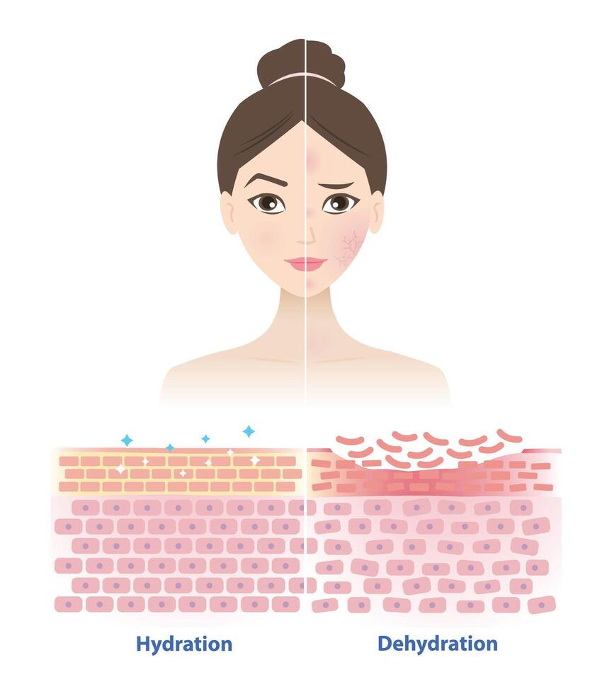 Comparison of healthy and dry skin on woman face illustration. Cross section of skin barrier layer hydration, attract, absorb water, moisture and the skin lacks water in the uppermost layer. vector