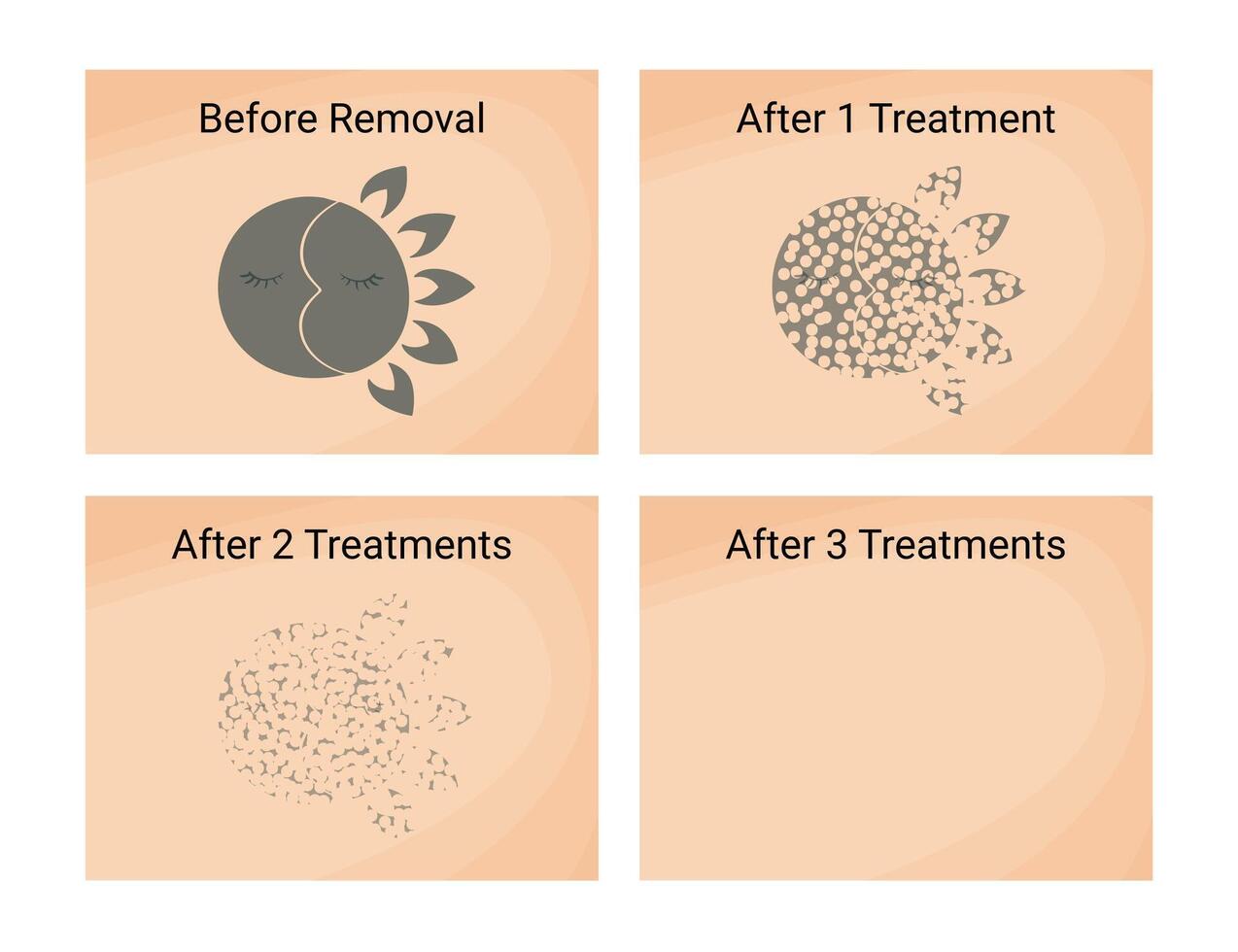 Laser Tattoo Removal Procedure before and after vector