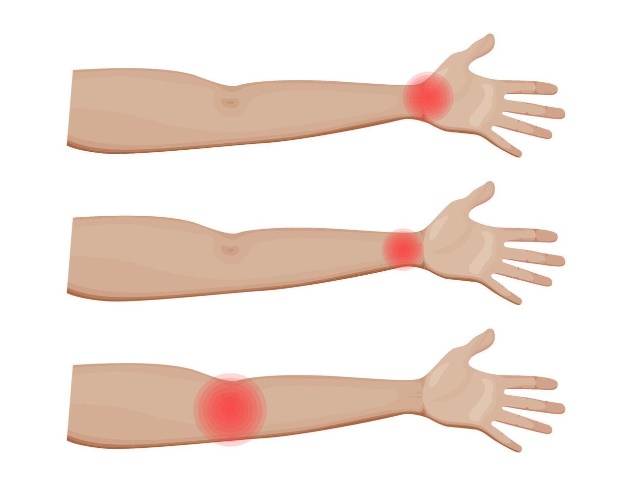 Shoulder and Elbow Joint Pain Illustration vector