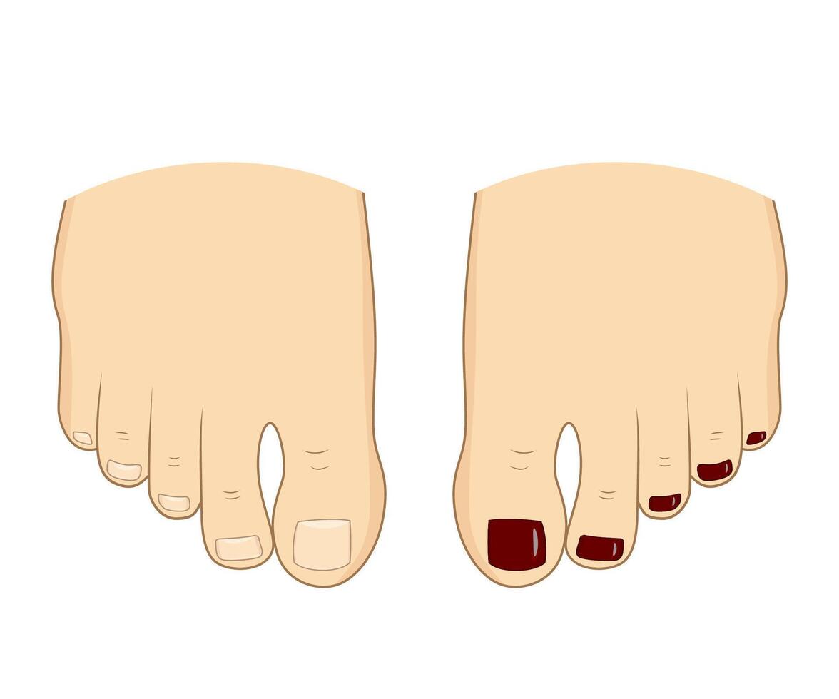 Feet with red nail polish on one foot and natural nails on the other. Perfect for themes like pedicure, nail care, beauty treatment, and foot care. Before and after. vector