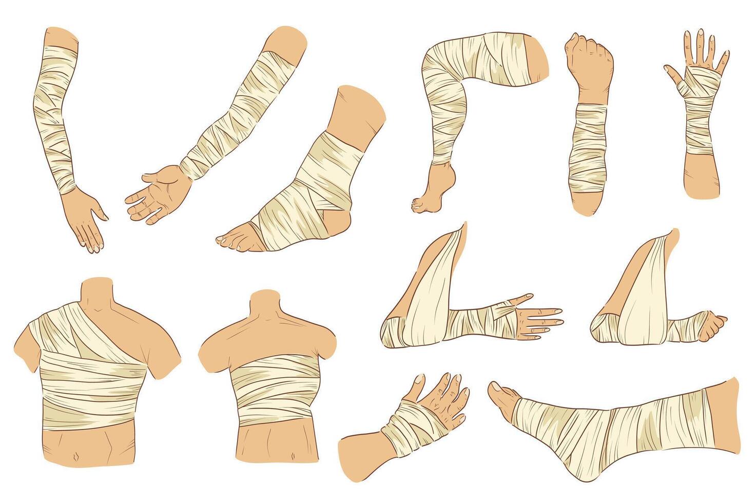 Bandaged body parts mega set elements in flat graphic design. Collection objects of injured legs, arms, palms, back, chest, torso, ankle, knees with bandage applying or gypsum. illustration. vector