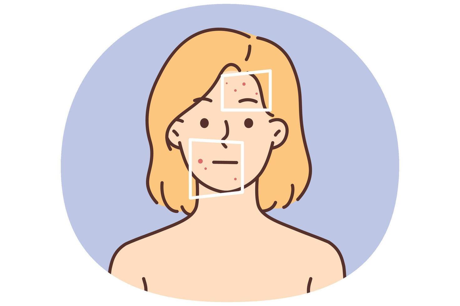 Woman with red pimples on face vector