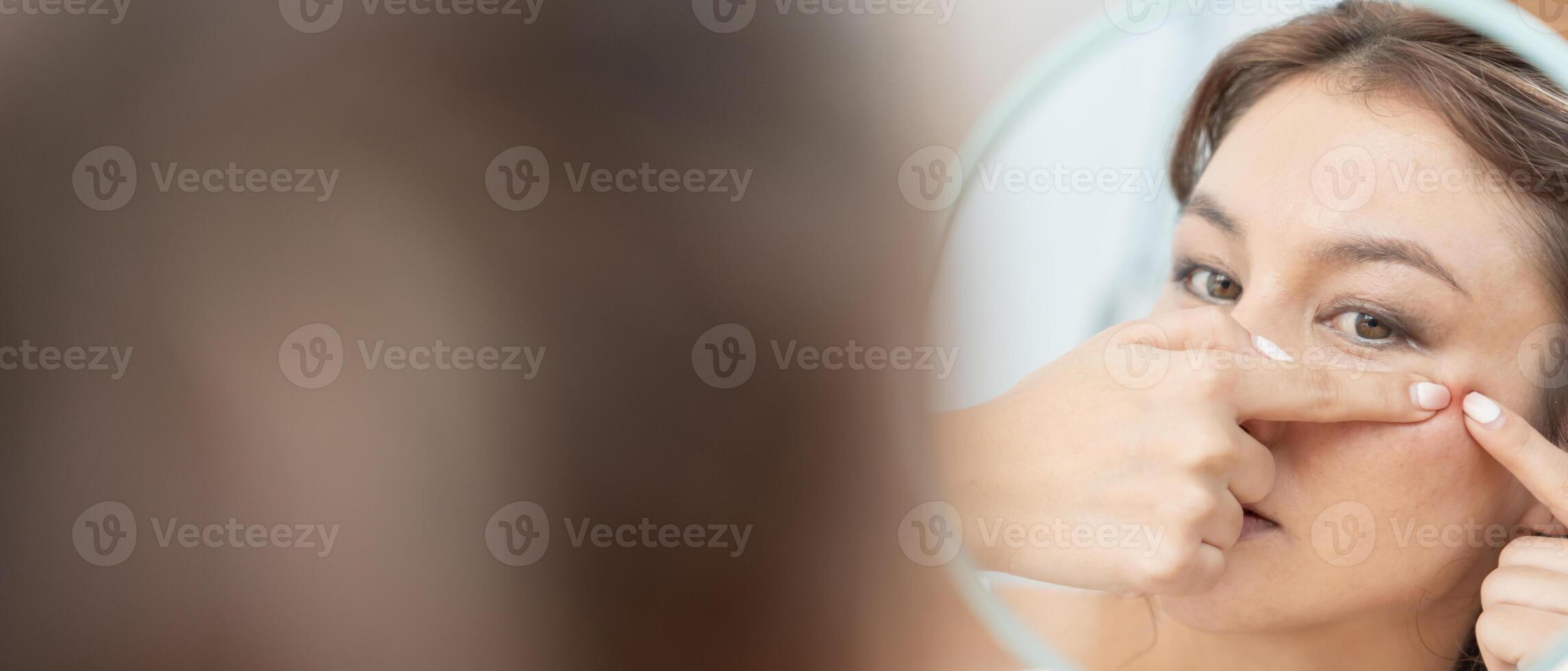 Young woman are worried about faces Dermatology and allergic to steroids in cosmetics. sensitive skin, red face from sunburn, acne, allergic to chemicals, rash on face. skin problems and beauty photo