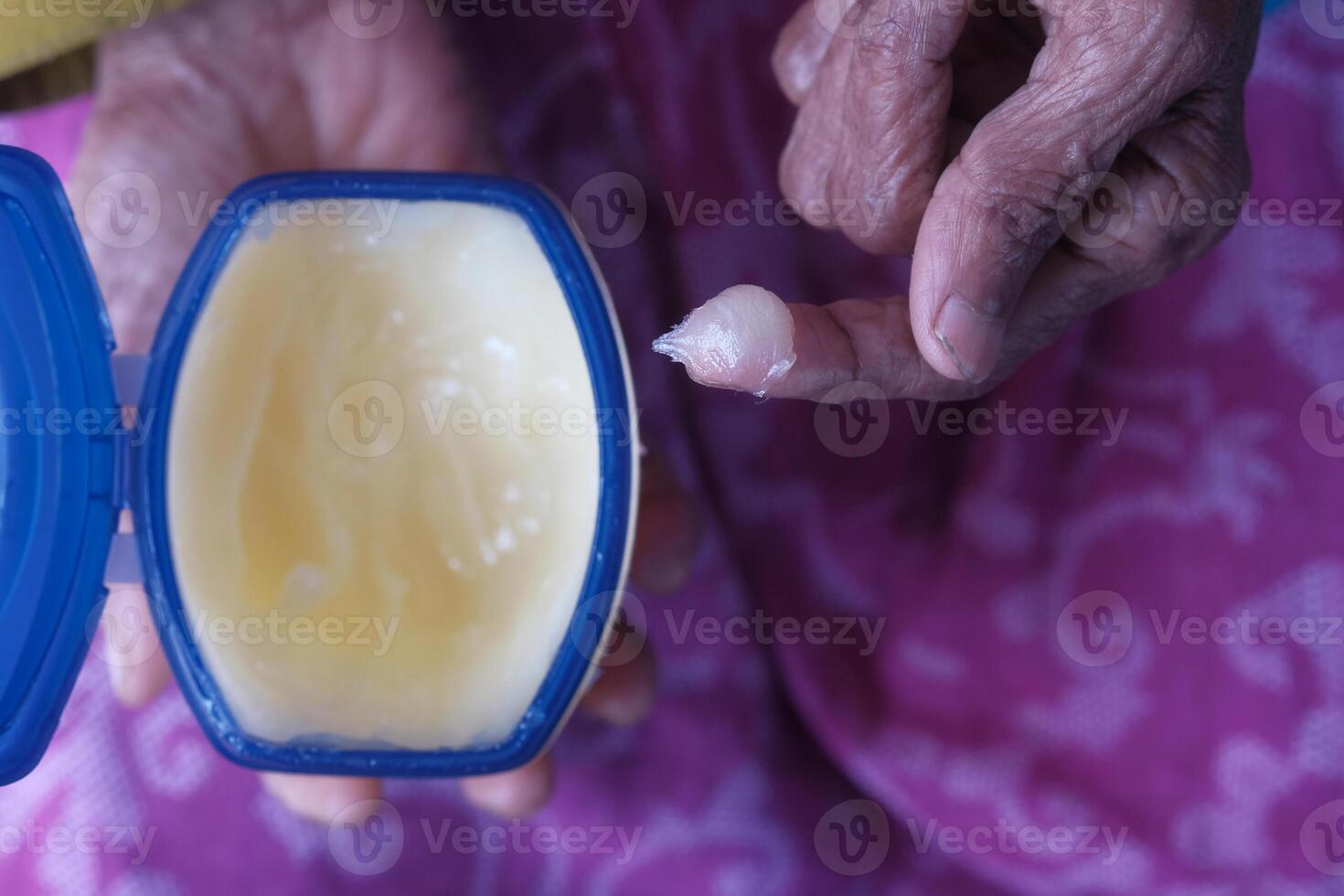 A CloseUp Image of a Hand Grasping a Moisturizing Ointment Contained within a Blue Container photo