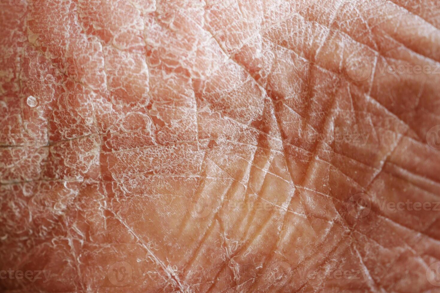 Closeup view of dry human skin . photo