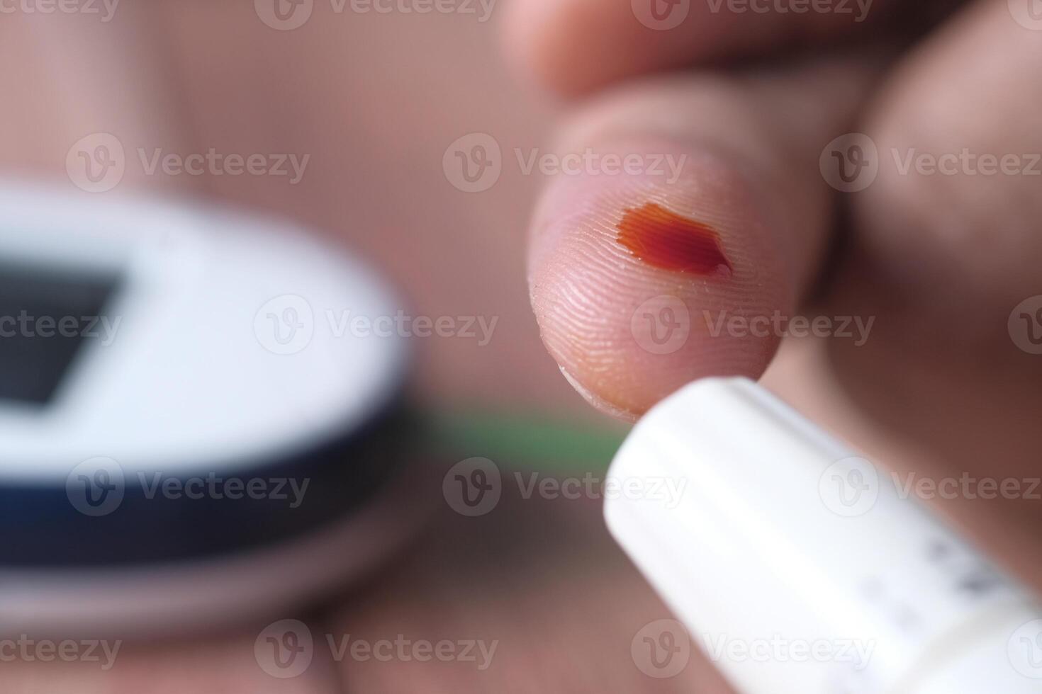 Blood Glucose Monitoring using a Glucometer along with a Blood Sample for Analysis photo