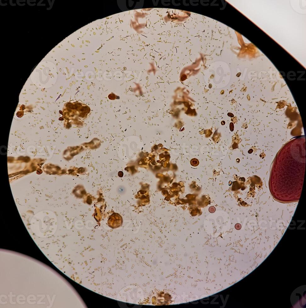 Close-up view of various microorganisms under a microscope, showcasing bacteria and other tiny particles. photo