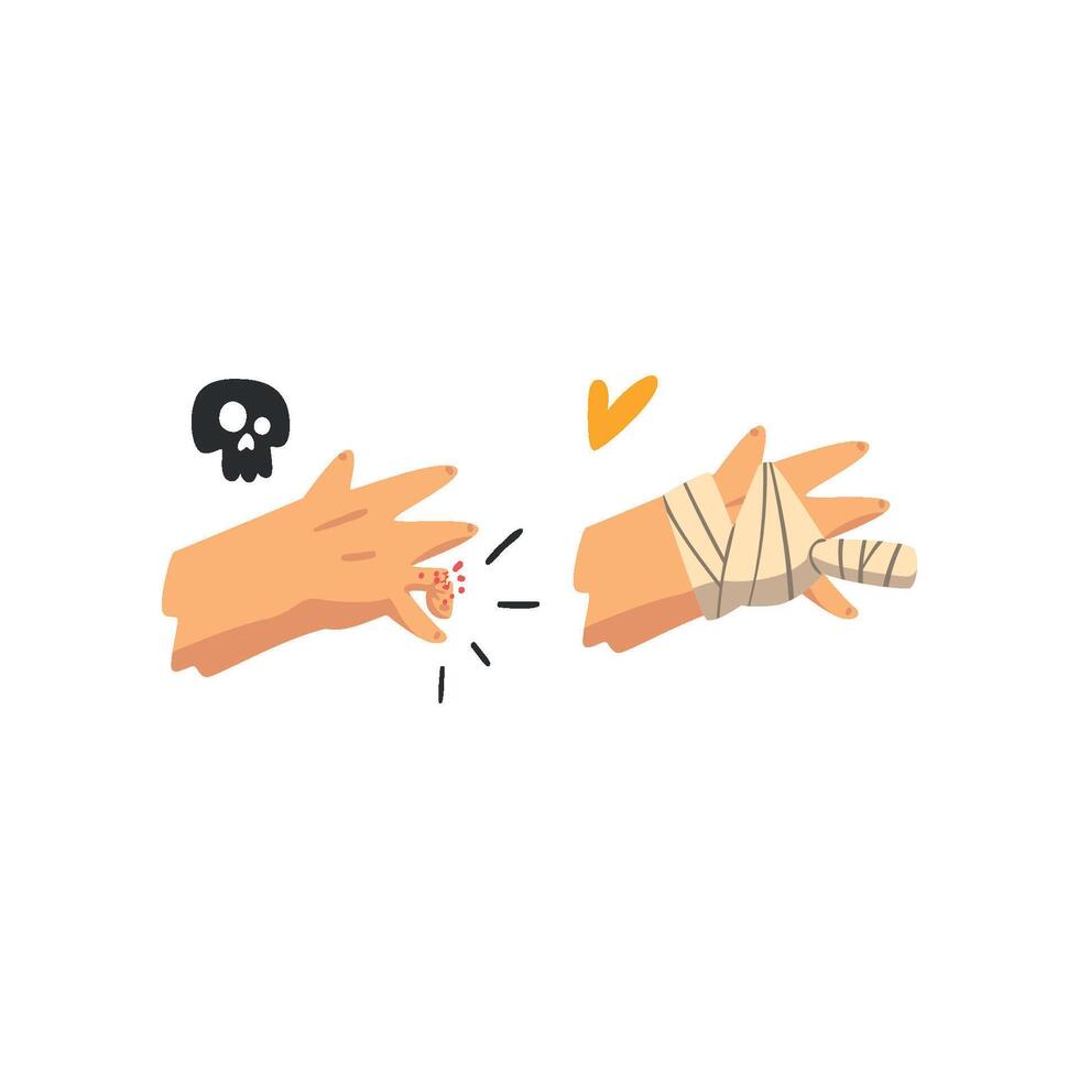 Fracture of the finger, hand plastered, physical injury, first aid and treatment Illustration on a white background vector