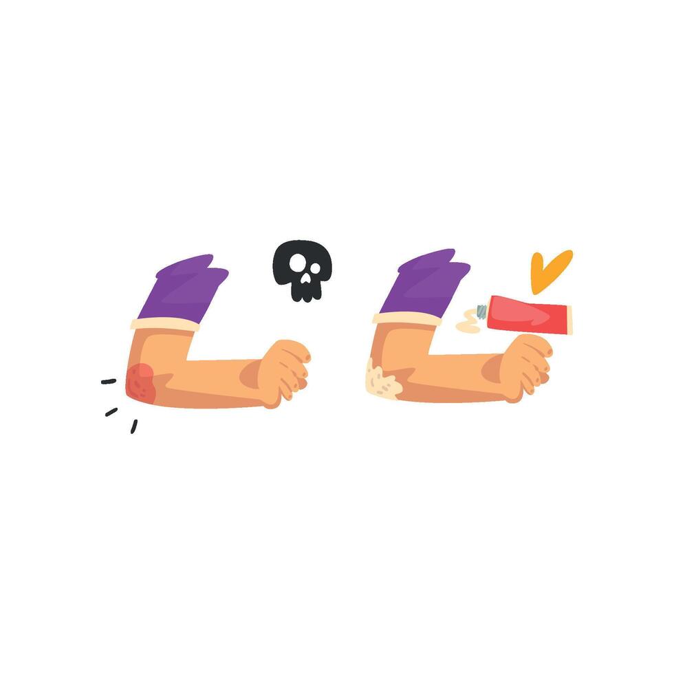 Elbow injury, first aid and treatment Illustration isolated on a white background vector