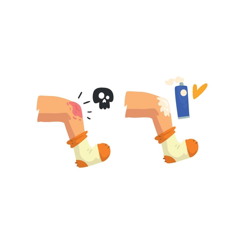 Knee injury, first aid and treatment Illustration on a white background vector