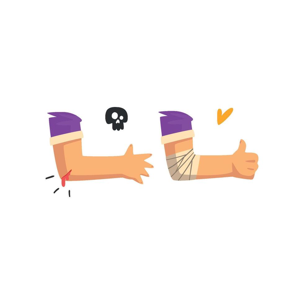 Wounded elbow with blood oozing, physical injury, first aid and treatment Illustration on a white background vector