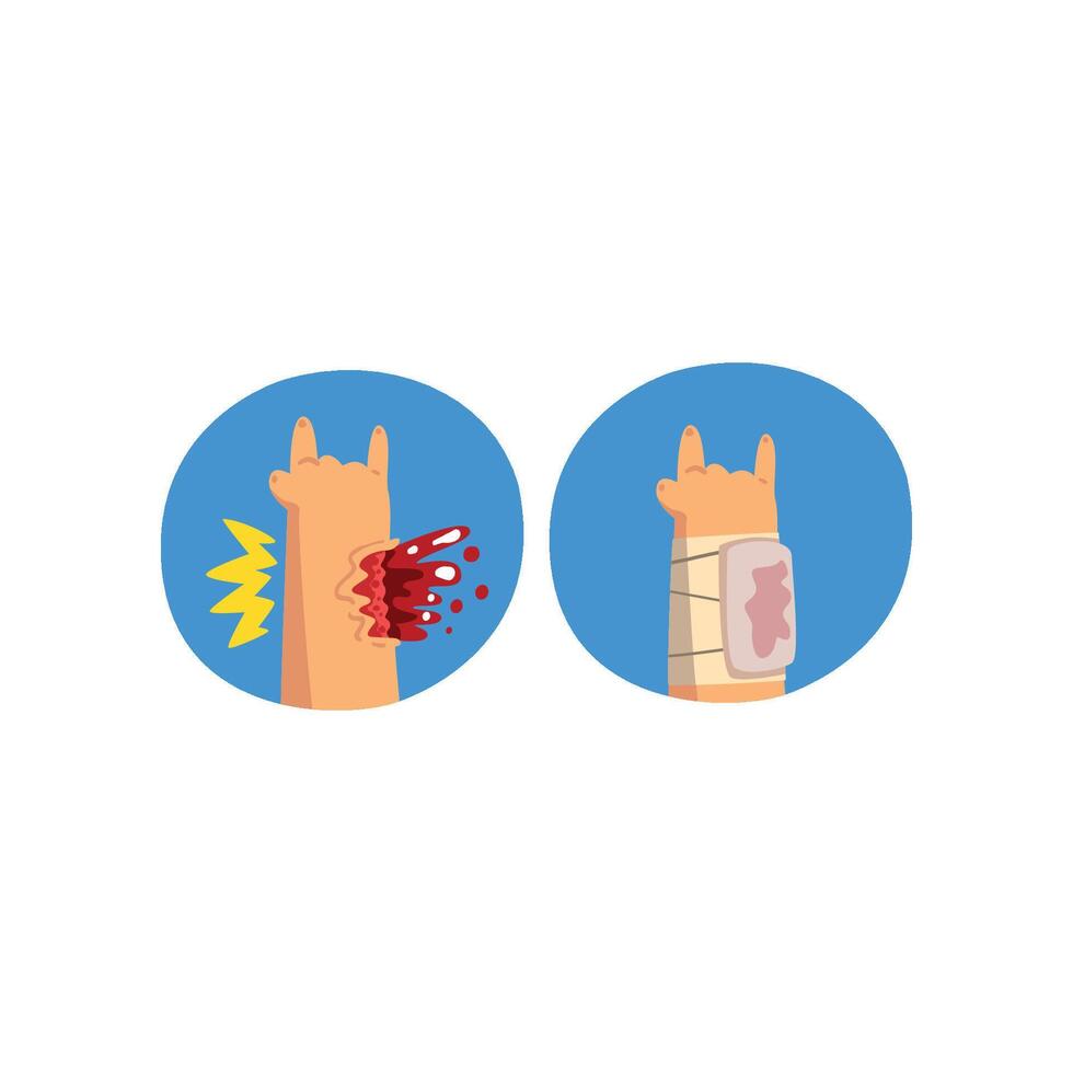 Wounded hand with blood oozing, first aid and treatment Illustration on a white background vector