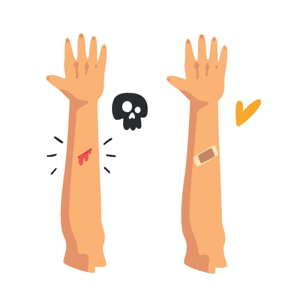 Bleeding wound on the hand, sticking plaster, physical injury, first aid and treatment Illustration on a white background vector