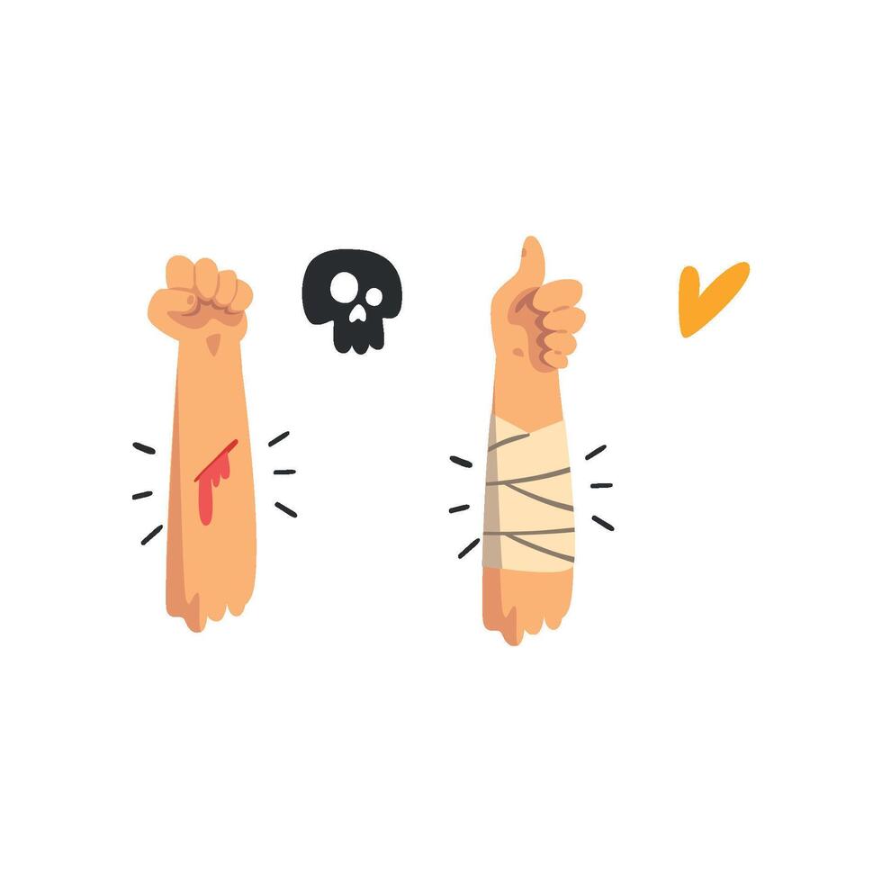 Bleeding wound on the hand, physical injury, bandaged hand, first aid and treatment Illustration on a white background vector