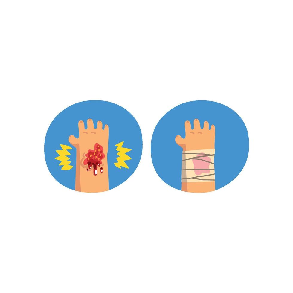 Wounded hand, physical injury, first aid and treatment Illustration on a white background vector