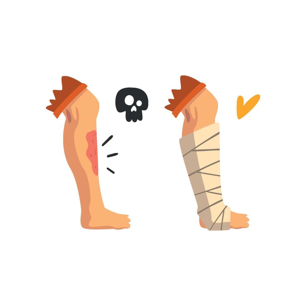 Wounded leg, physical injury, bandaged leg, first aid and treatment Illustration on a white background vector