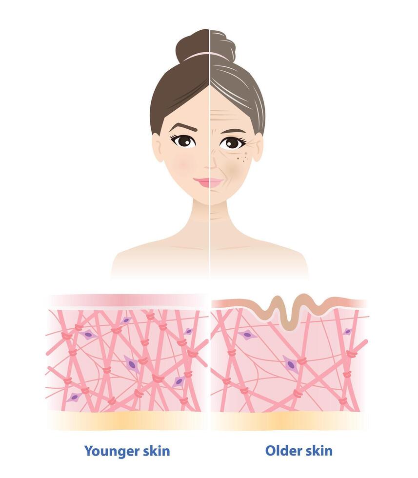 Aging process comparison. The difference between younger and older skin on woman face illustration. Cross section of high and low density of collagen, elastin fibers and fibroblasts in dermis. vector