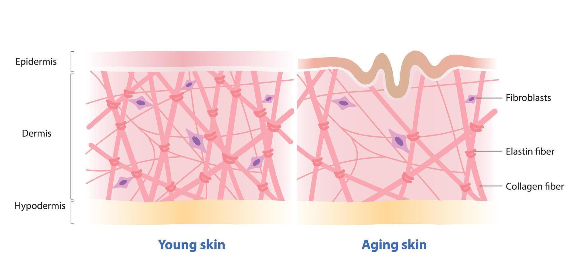 Comparison of young and aging skin on white background. Cross section of high and low density of collagen, elastin fibers and fibroblasts in the dermis layer. Skin care and beauty concept. vector