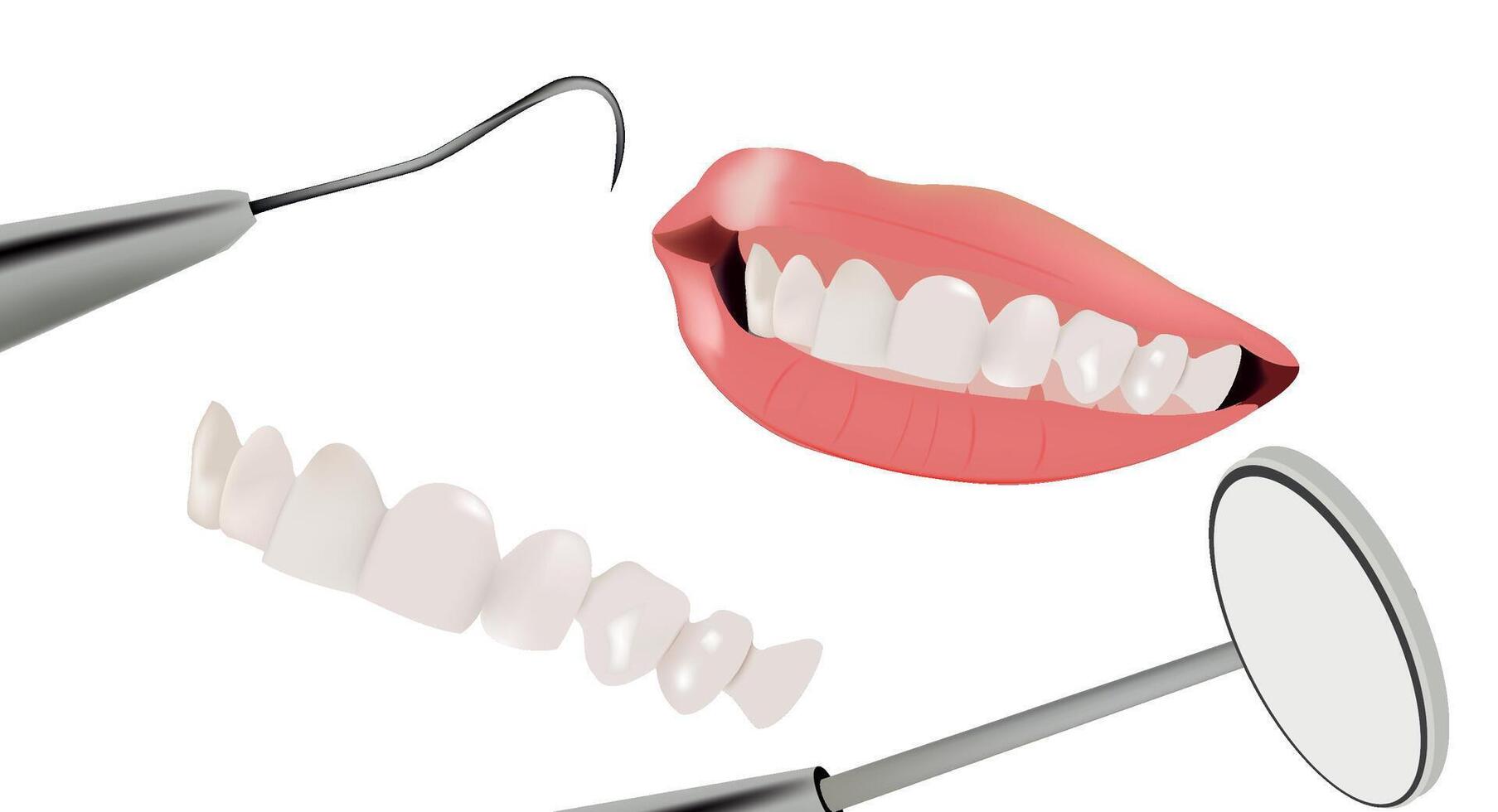 Dental implants and dental veneers vector
