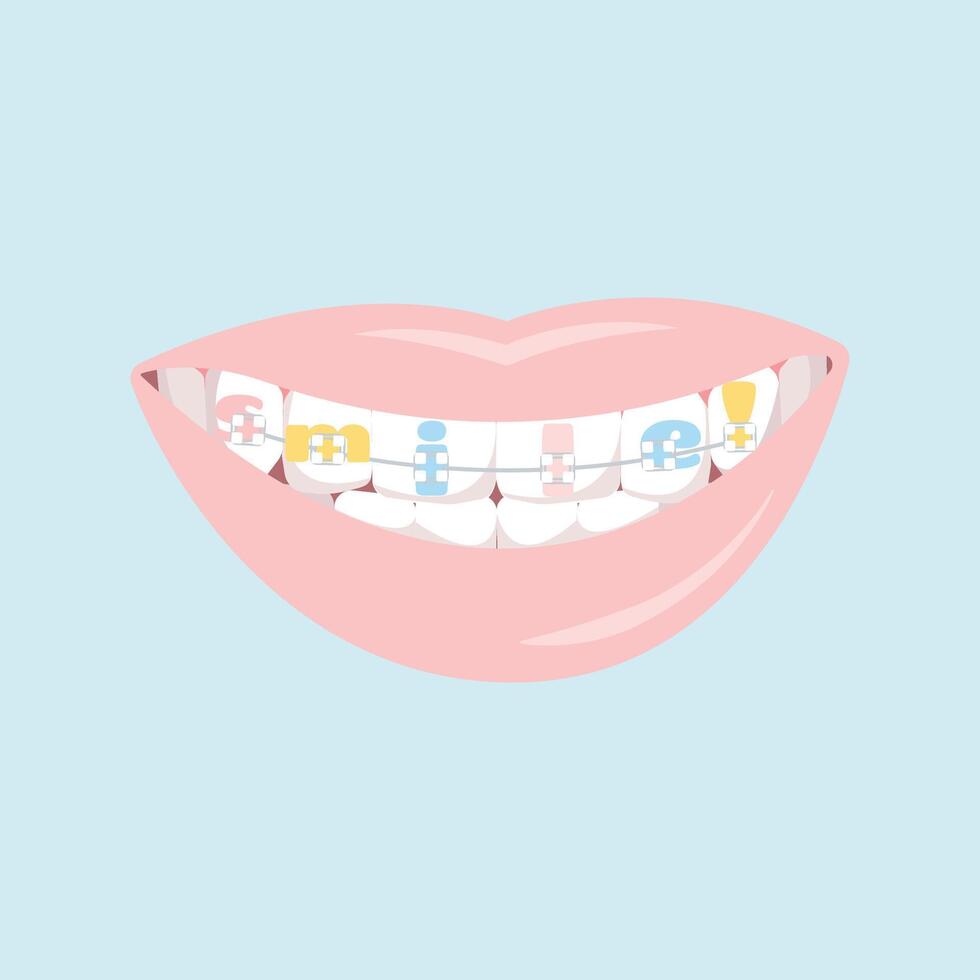 Teeth dental braces with word smile, isolated on white background, illustration in pastel calm colors. vector