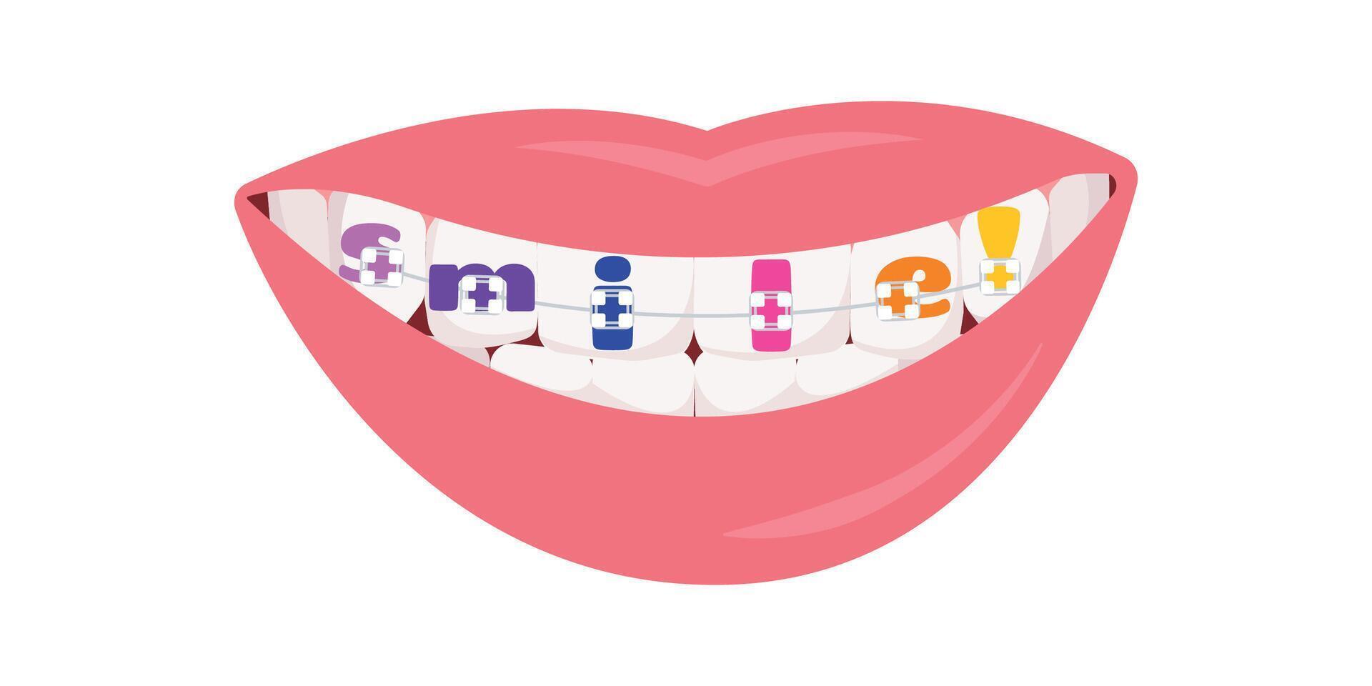 Teeth dental braces with word smile, isolated on white background, illustration vector