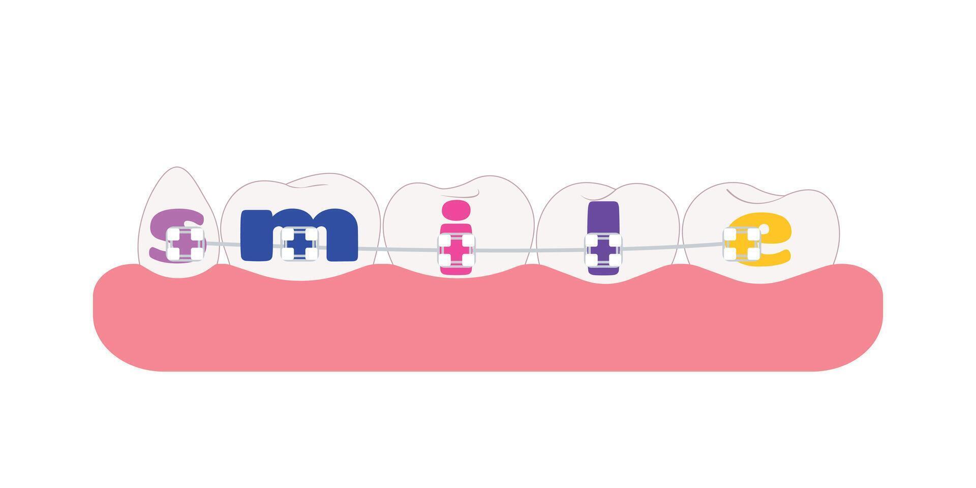 Teeth with Dental braces with the word Smile. Dental braces on white tooth orthodontic bracket correction treatment concept. flat design cartoon style dentistry clip art illustration. vector