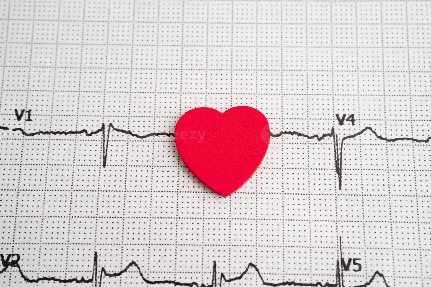 Electrocardiogram ECG, heart wave, heart attack, cardiogram report. photo