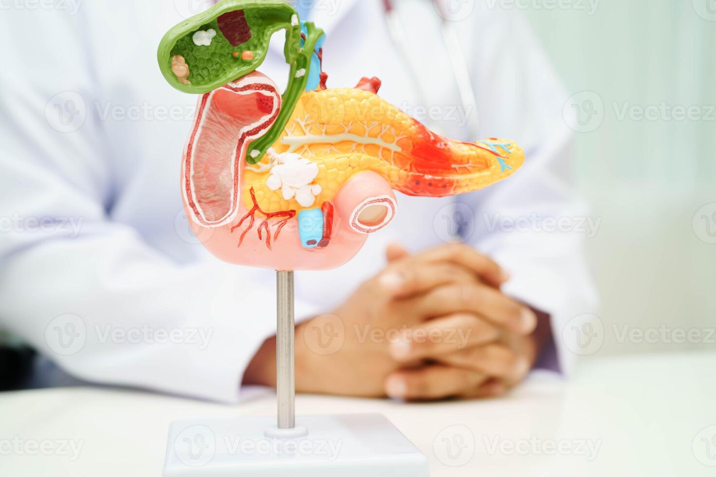 Pancreatitis, pancreatic cancer, Asian doctor with pancreas, gallbladder and bile duct human anatomy model at hospital. photo