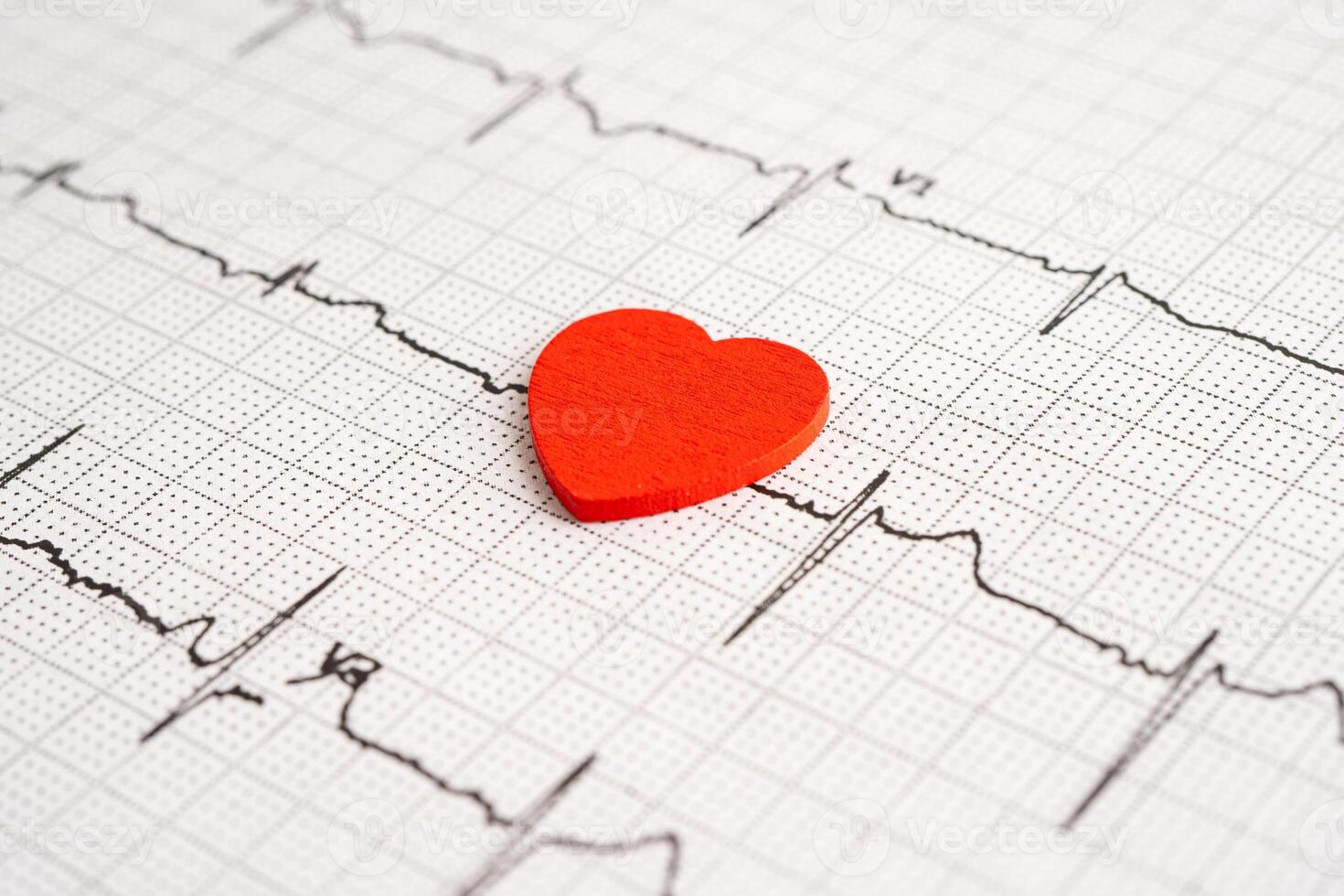Stethoscope on electrocardiogram ECG with red heart and drug, heart wave, heart attack, cardiogram report. photo