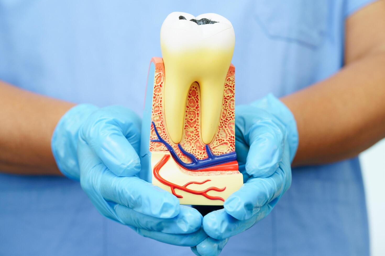 Dentist holding dental implant, artificial tooth roots into jaw, root canal of dental treatment, gum disease, teeth model for dentist. photo